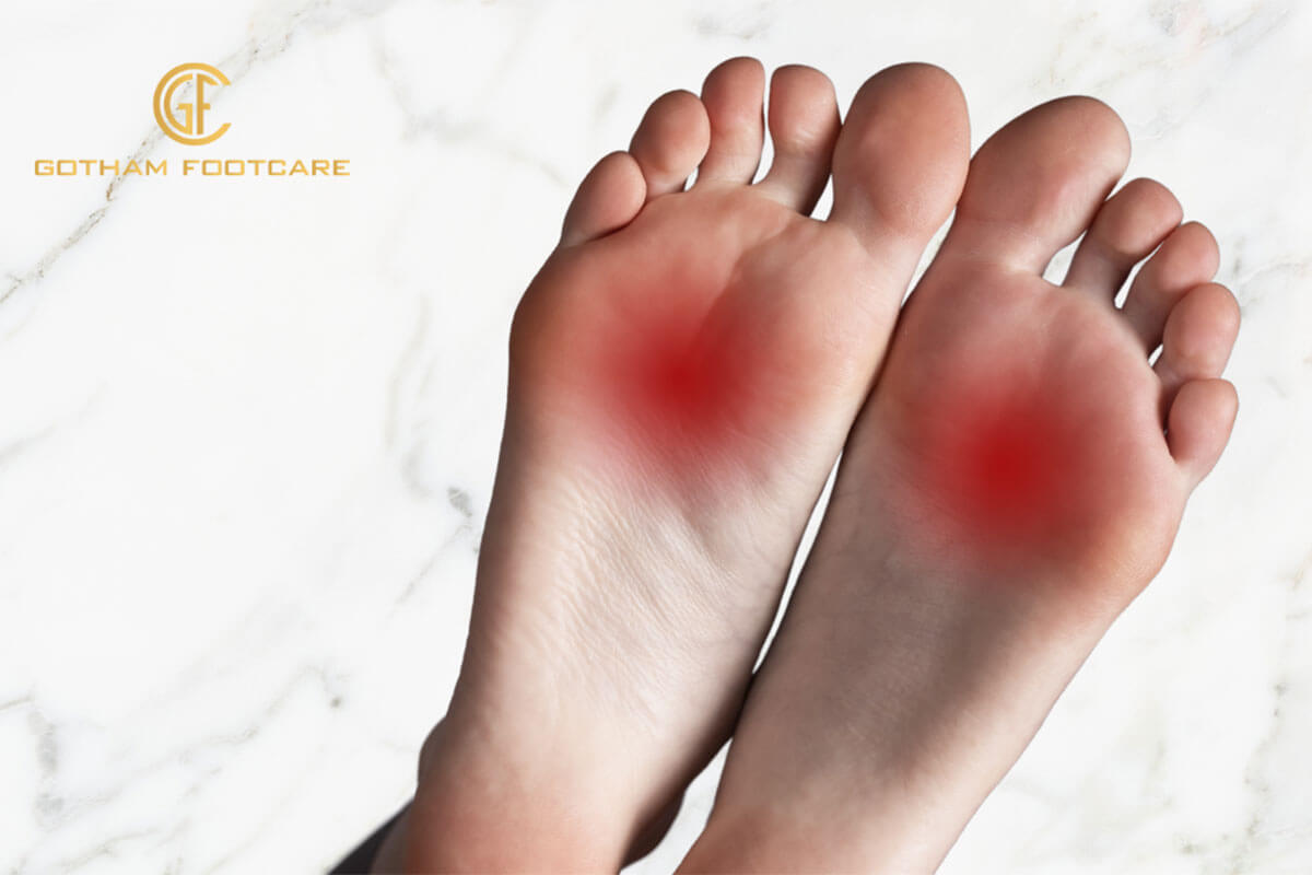 How to Treat Morton’s Neuroma at Home and at the Doctors